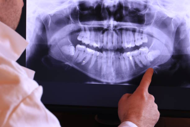 Professional Emergency Dentist in WY